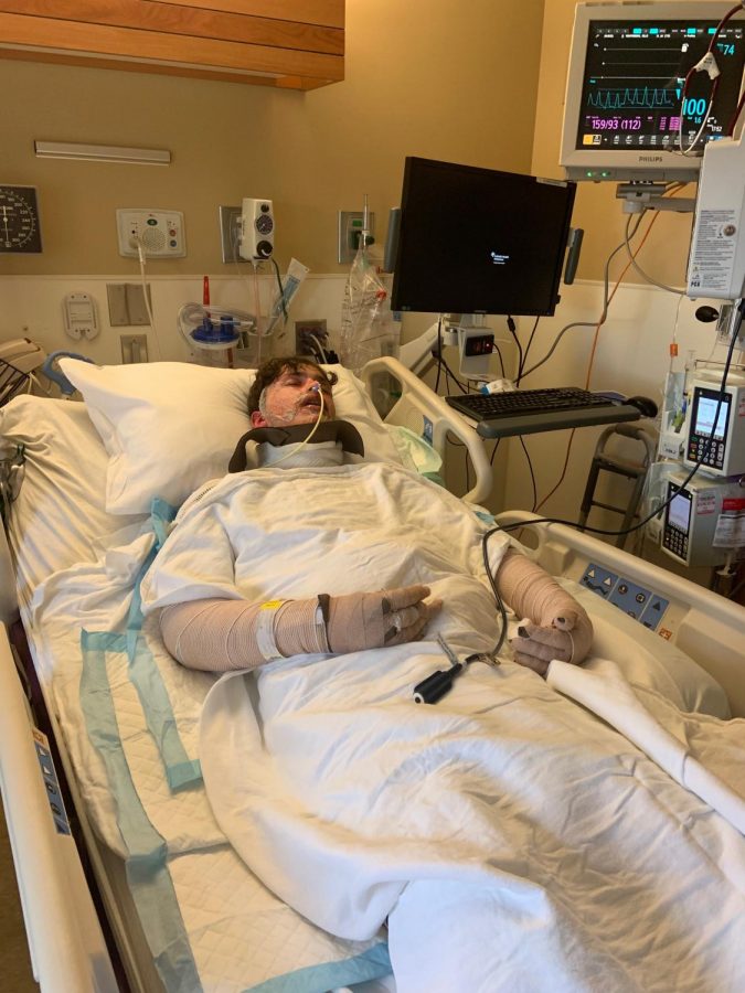 Hanging on to his life, sophomore Dillon Von Freiberg receives treatment for Steven-Johnson Syndrome. Von Freiberg spent an entire month in the burn unit of the hospital where he wasn’t able to eat, drink, or move. “I had just gotten out of surgery, they had to put a feeding tube in me because everything including my mouth blistered,” Von Freiberg said. “I wasn’t able to eat food and I was passed out because of the meds they gave me.”